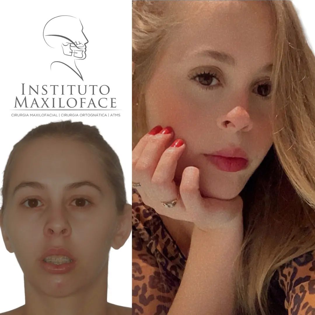 ATM - Instituto Maxilo Facial