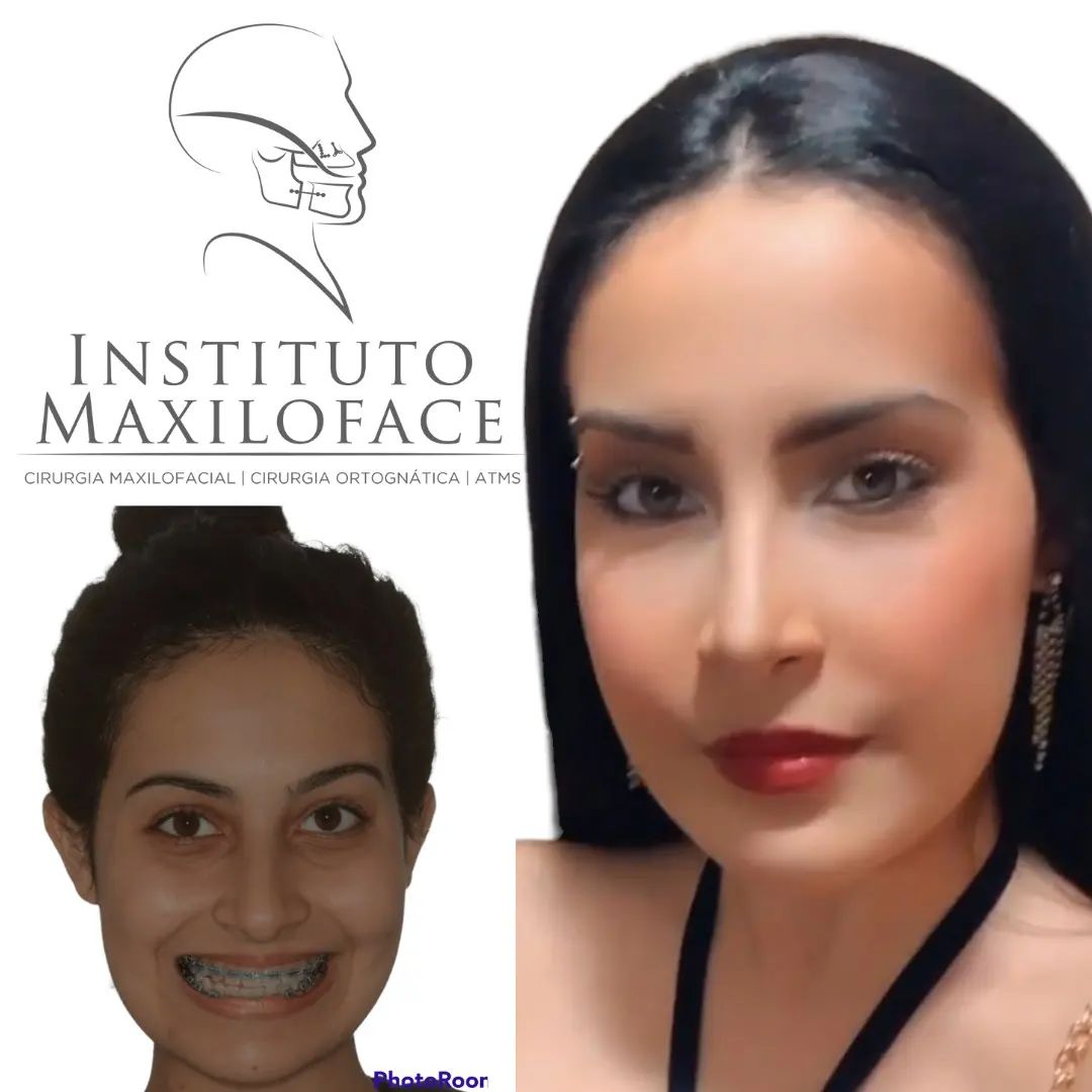 ATM - Instituto Maxilo Facial